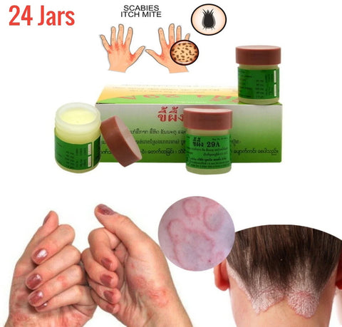 29A Natural Aid for Scabies, Jock Itch, Ringworm, Athletes Foot, Herpes, ANY Itching - Herbal, Fast Acting - 5 Year Shelf Life