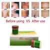 Image of 29A Miracle All-Natural  Anti-Itch Ointment Helps All Kinds of Itching & Rashes from Scabies, Jock Itch, Ringworm, Athletes Foot, Herpes, ANY Itching - Herbal, Fast Acting - 5 Year Shelf Life -  (2 Jars x 7.5g each)