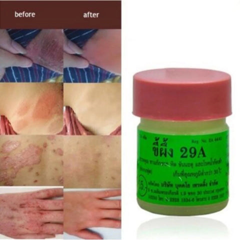 29A Miracle All-Natural  Anti-Itch Ointment Helps All Kinds of Itching & Rashes from Scabies, Jock Itch, Ringworm, Athletes Foot, Herpes, ANY Itching - Herbal, Fast Acting - 5 Year Shelf Life -  (2 Jars x 7.5g each)